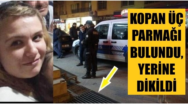 Baltayla saldırıda kopan parmakları yerine dikildi